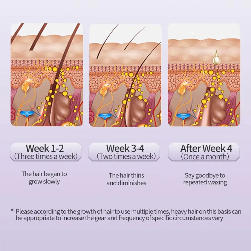 ECULIX™ IPL Hair Removal Device